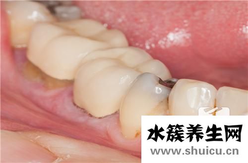 抽煙牙黃怎么辦