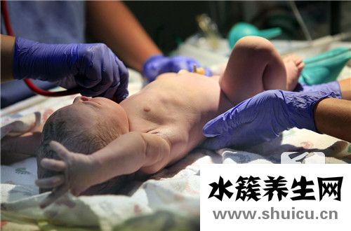 新生兒黃疸正常范圍