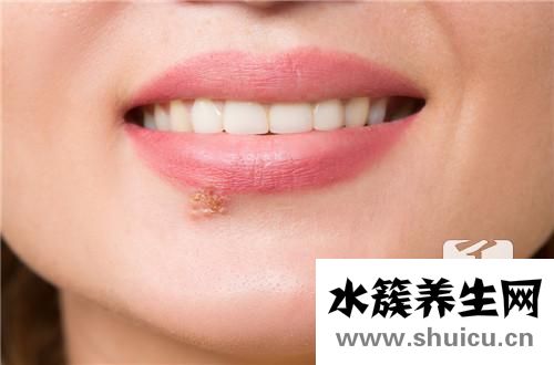 病毒感染吃什么藥