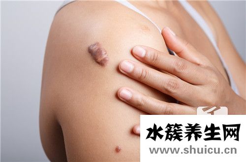 皮下長(zhǎng)疙瘩