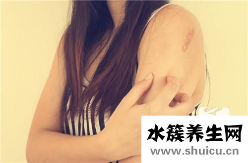 泡疹最佳治療方法