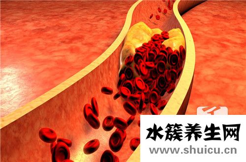 血清總膽固醇增高