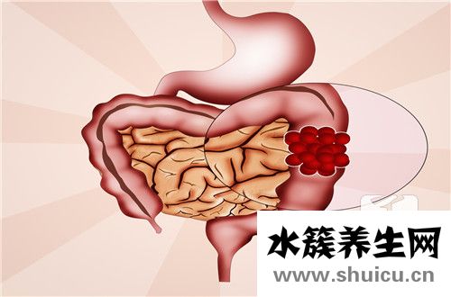低級(jí)別上皮內(nèi)瘤變