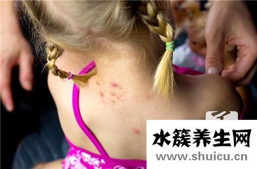 濕毒最佳治療方法