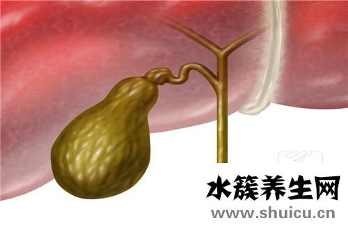 膽囊息肉怎么引起的
