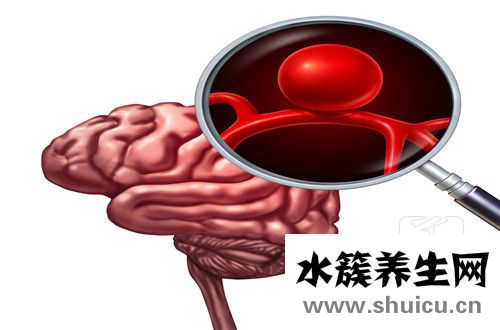 腔梗和腦梗的區別