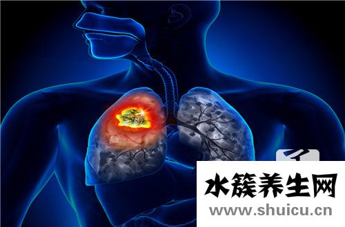 癌癥晚期死前征兆