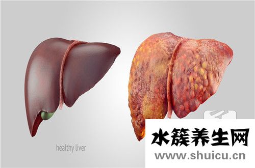 肝脂肪浸潤是什么意思