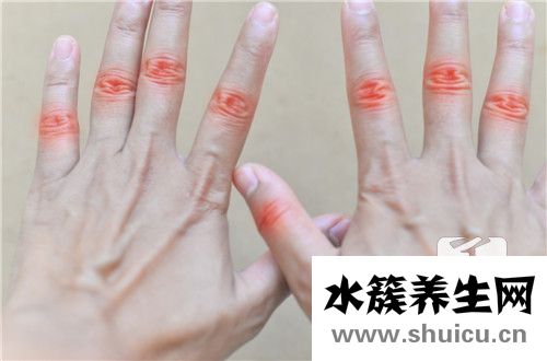 毛囊炎疙瘩怎么治療