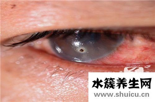 眼睛干澀用什么眼藥水