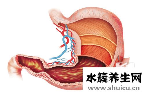 胃反酸是怎么回事