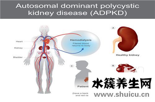 酒精肝怎么治療