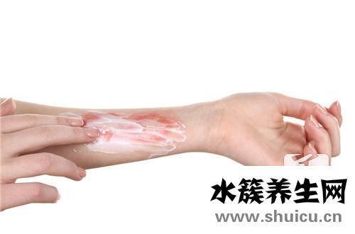 結痂后怎樣不留疤痕