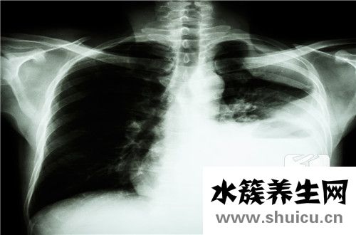 中性細(xì)胞比率偏低