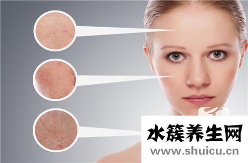 男生青春痘治療方法