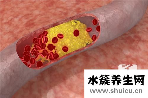 肝臟上的血管瘤