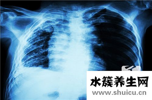 肺部鈣化灶是什么意思