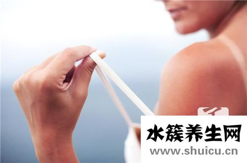 皮膚曬傷后怎么辦