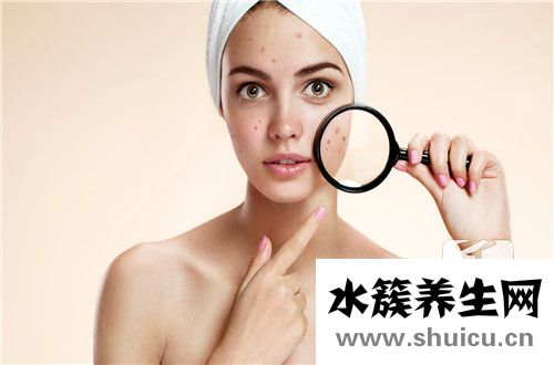 去除臉上痤瘡