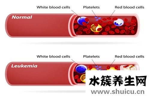 無償獻血的危害