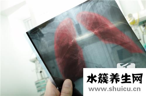 什么是肺動脈高壓