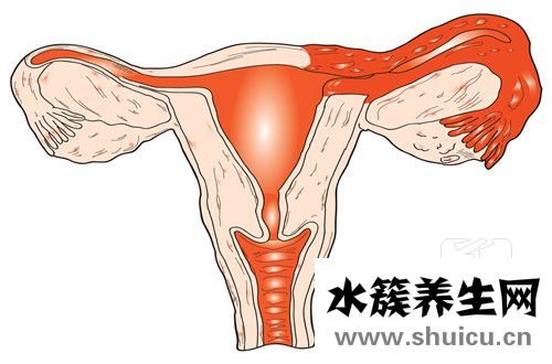 卵巢囊腫吃什么藥好