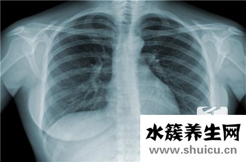 結核菌怎么治療