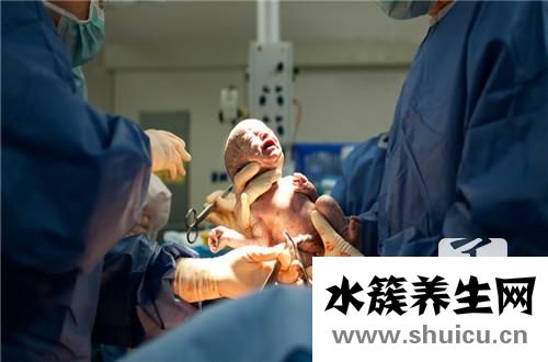 剖腹產(chǎn)的最佳時(shí)間