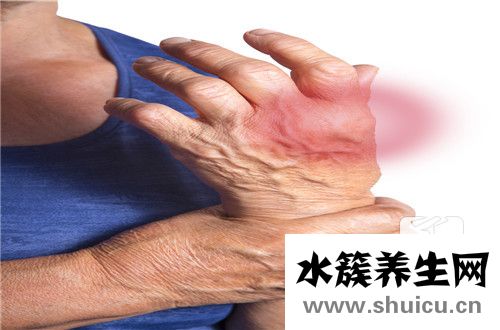 風濕性關節炎中醫治療