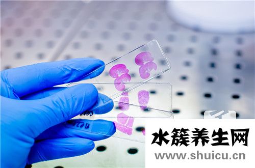 癌胚抗原是什么