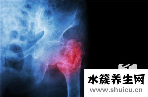 盆腔炎會導致不孕嗎