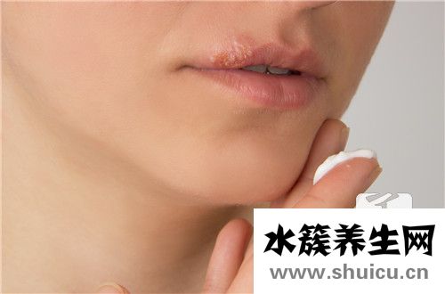 帶狀皰疹怎么引起的