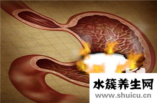 胃癌的早期癥狀和前兆