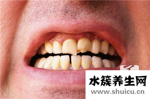 牙縫變大怎么辦