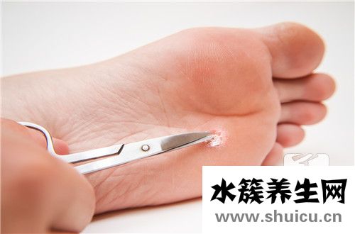 兒童傳染性軟疣