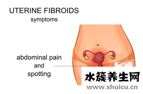 子宮腺肌癥的癥狀