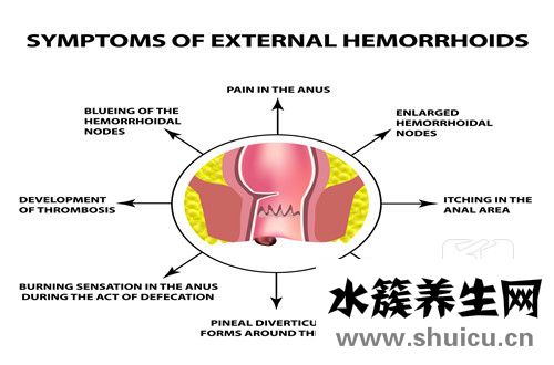 痔瘡用什么藥最好