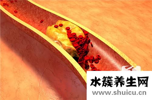 總膽固醇偏高的原因