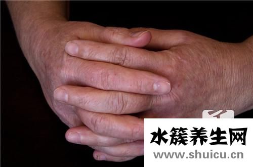 過敏性紫癜癥狀