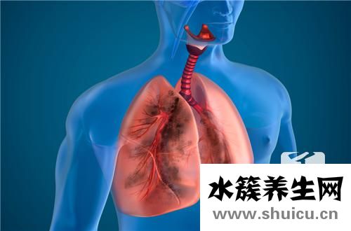 支氣管擴張咯血