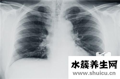 右側(cè)肋骨下隱痛