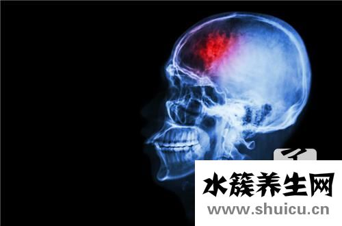 彌漫性軸索損傷