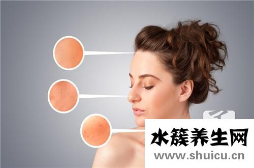 蛇盤瘡最佳治療方法