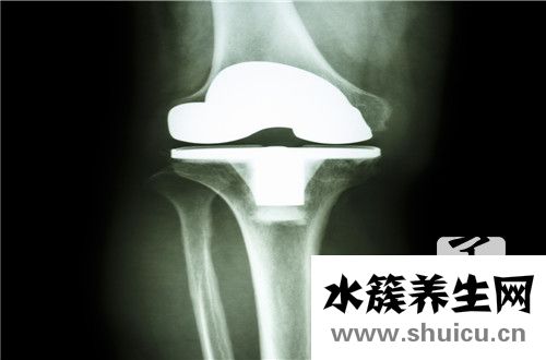 脛骨結節骨骺炎