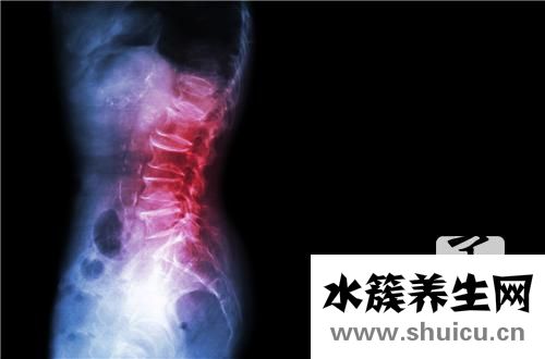 脊椎疼