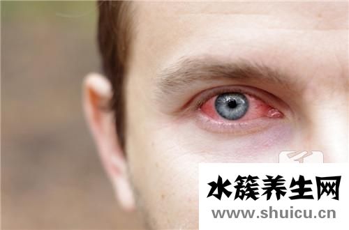 過敏性結膜炎癥狀