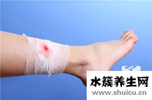 傷口化膿怎么處理