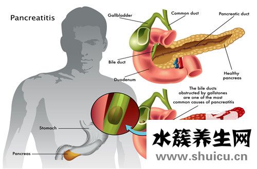 做彩超要空腹嗎
