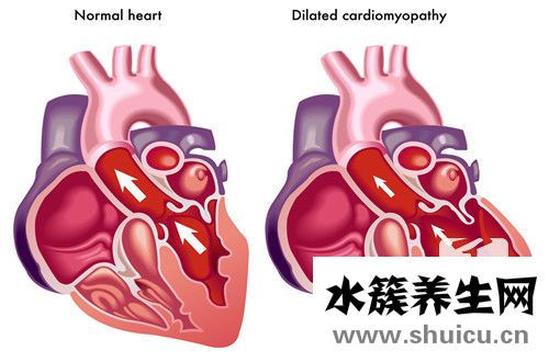 了支架手術(shù)禁忌什么