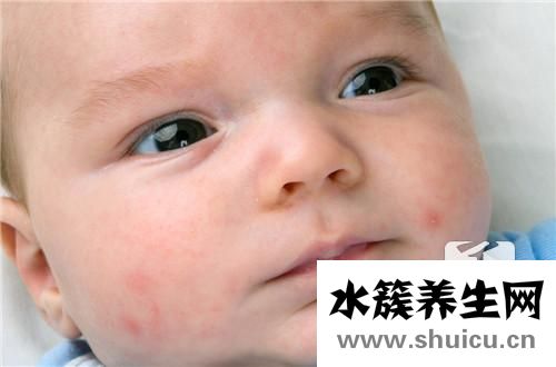 寶寶身上長(zhǎng)了很多小紅點(diǎn)